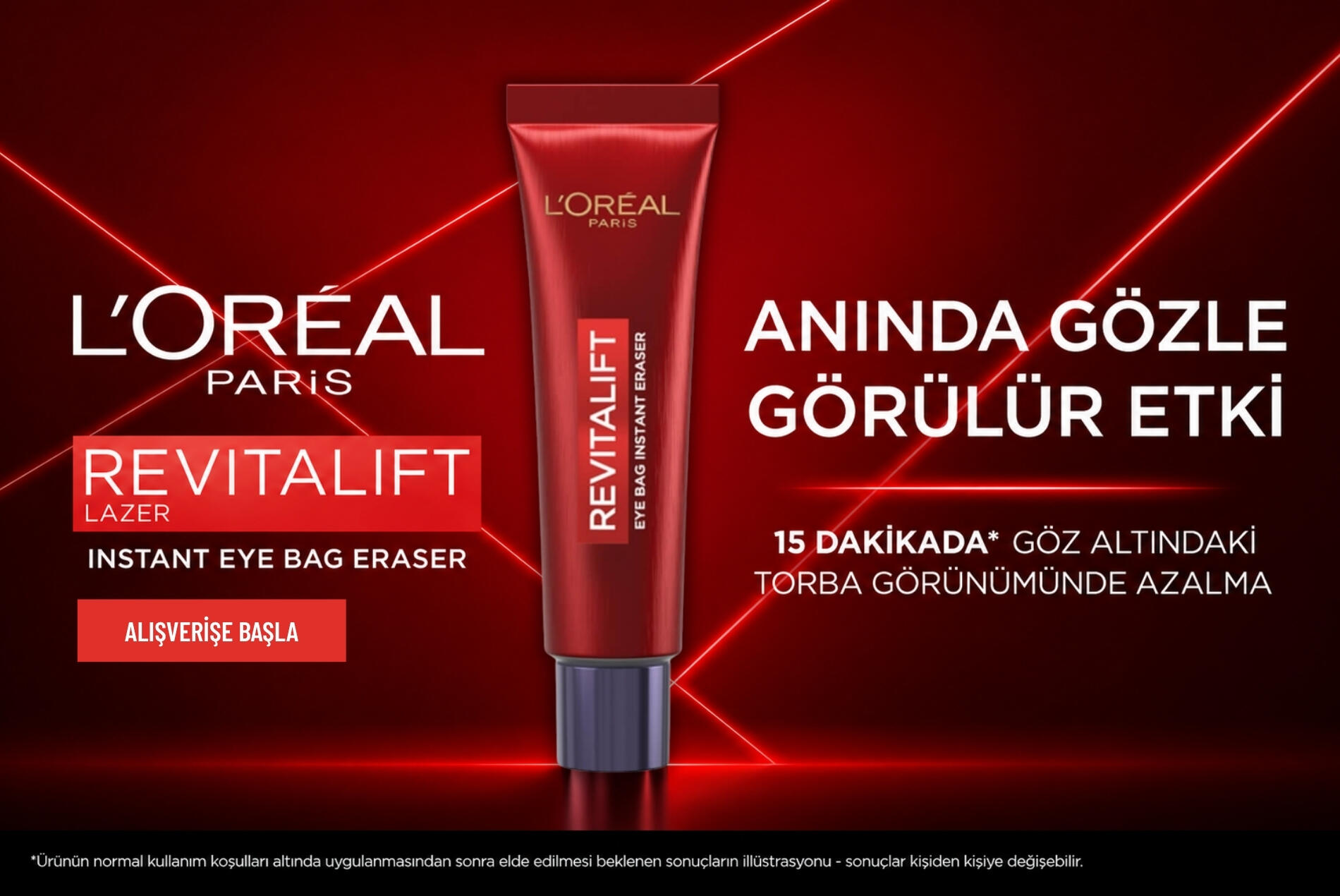 Loreal