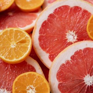 Anthology L'Homme Erkek Parfüm Edp 100 Ml - 3