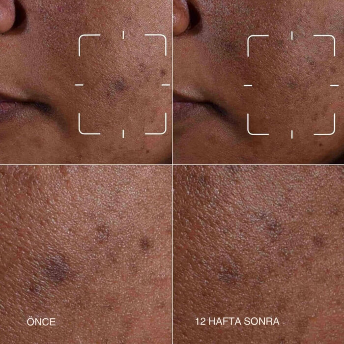 Clinique Even Better Dark Spot Serum 50 Ml - 3