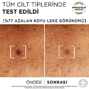 L'Oréal Paris Bright Reveal Sivilce, Güneş, Yaşlanma Lekelerinde Etkili Koyu Leke Karşıtı Serum 10% Niasinamid 30 Ml - 3