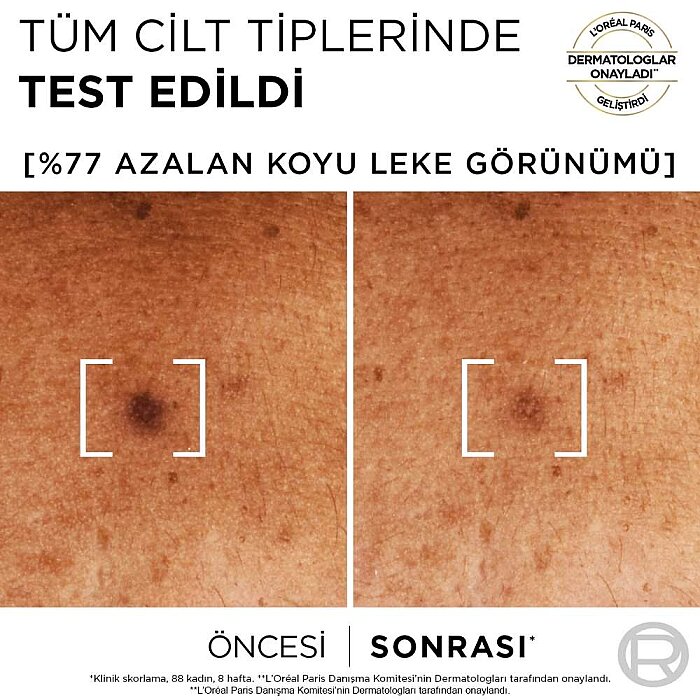 L'Oréal Paris Bright Reveal Sivilce, Güneş, Yaşlanma Lekelerinde Etkili Koyu Leke Karşıtı Serum 10% Niasinamid 30 Ml - 3