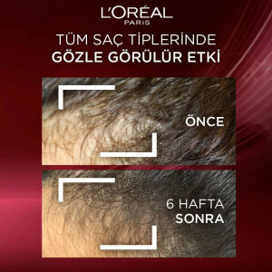L'Oréal Paris Elseve Komple Direnç Saç Bakım Kremi 250 Ml - 5