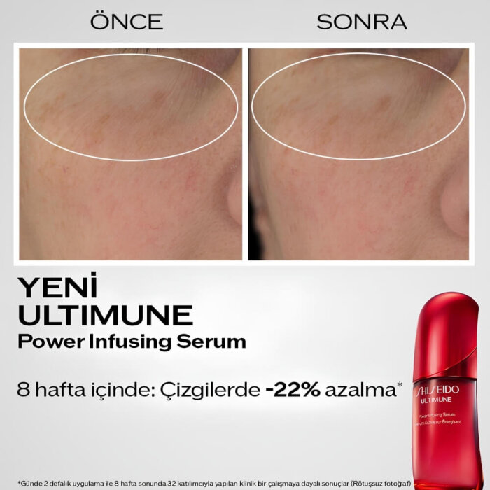Shiseido Ultimune Power Infusing Concentrate Serum 120 Ml - 5