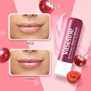 Vaseline Lipstick Cherry 4.8 Gr - 5