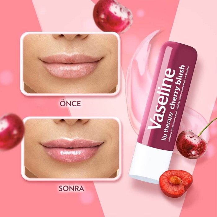 Vaseline Lipstick Cherry 4.8 Gr - 5